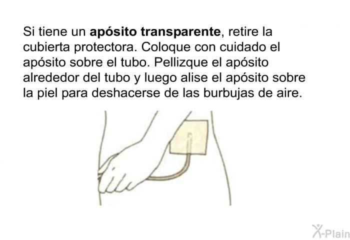 Si tiene un<B> apsito transparente</B>, retire la cubierta protectora. Coloque con cuidado el apsito sobre el tubo. Pellizque el apsito alrededor del tubo y luego alise el apsito sobre la piel para deshacerse de las burbujas de aire.