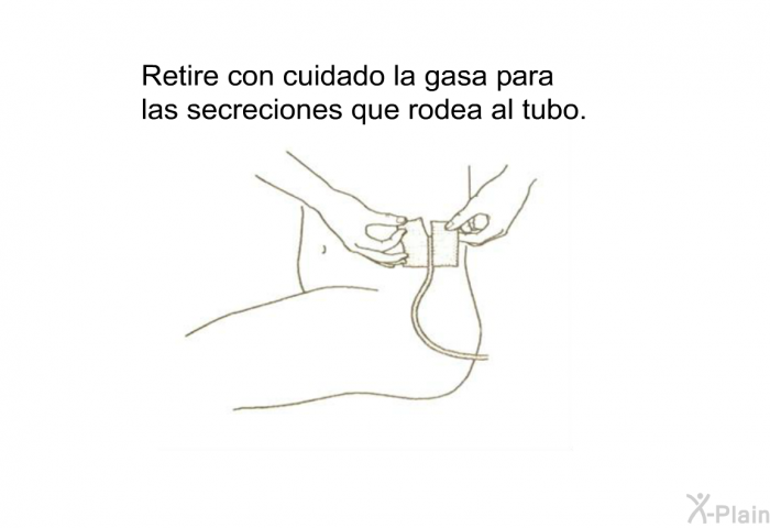 Retire con cuidado la gasa para las secreciones que rodea al tubo.