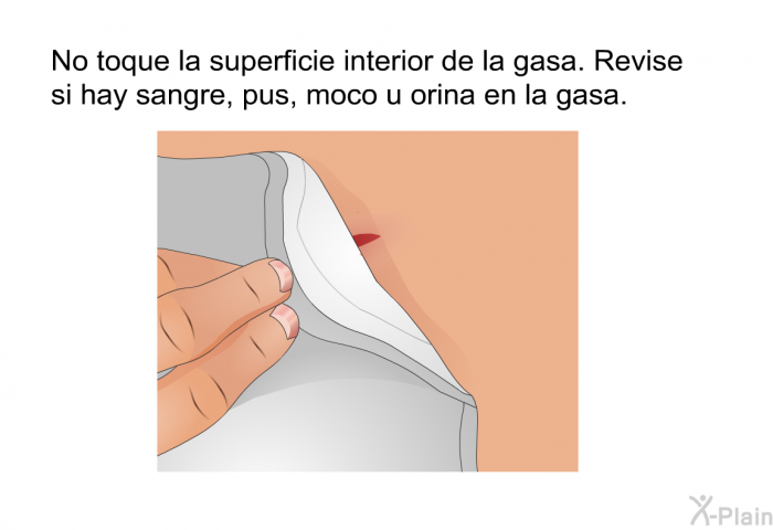 No toque la superficie interior de la gasa. Revise si hay sangre, pus, moco u orina en la gasa.