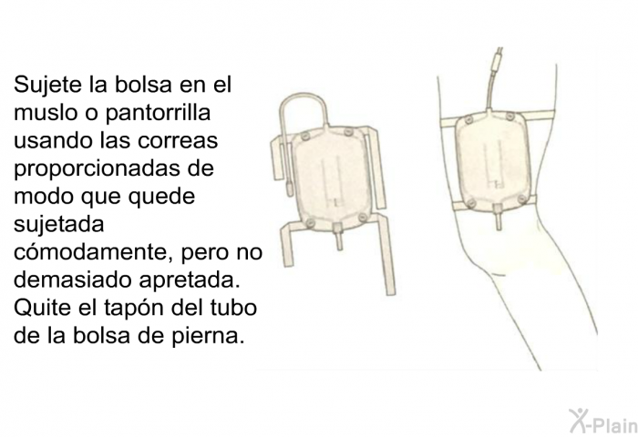 Sujete la bolsa en el muslo o pantorrilla usando las correas proporcionadas de modo que quede sujetada cmodamente, pero no demasiado apretada. Quite el tapn del tubo de la bolsa de pierna.