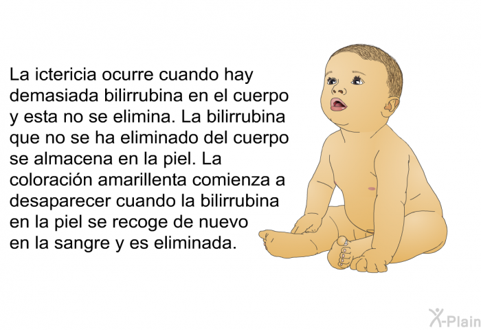 La ictericia ocurre cuando hay demasiada bilirrubina en el cuerpo y esta no se elimina. La bilirrubina que no se ha eliminado del cuerpo se almacena en la piel. La coloracin amarillenta comienza a desaparecer cuando la bilirrubina en la piel se recoge de nuevo en la sangre y es eliminada.