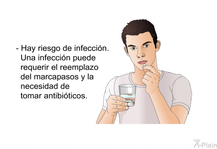 Hay riesgo de infeccin. Una infeccin puede requerir el reemplazo del marcapasos y la necesidad de tomar antibiticos.