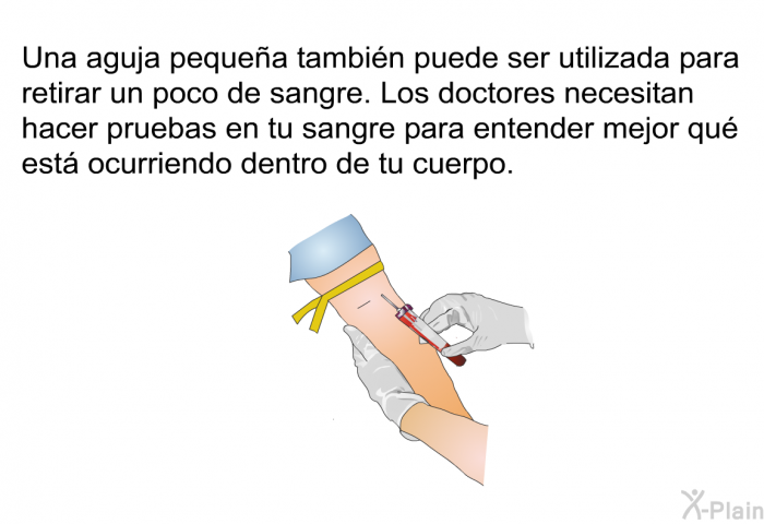 Una aguja pequea tambin puede ser utilizada para retirar un poco de sangre. Los doctores necesitan hacer pruebas en tu sangre para entender mejor qu est ocurriendo dentro de tu cuerpo.