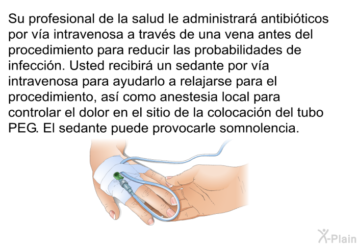 Su profesional de la salud le administrar antibiticos por va intravenosa a travs de una vena antes del procedimiento para reducir las probabilidades de infeccin. Usted recibir un sedante por va intravenosa para ayudarlo a relajarse para el procedimiento, as como anestesia local para controlar el dolor en el sitio de la colocacin del tubo PEG. El sedante puede provocarle somnolencia.