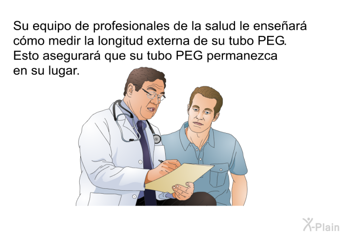 Su equipo de profesionales de la salud le ensear cmo medir la longitud externa de su tubo PEG. Esto asegurar que su tubo PEG permanezca en su lugar.