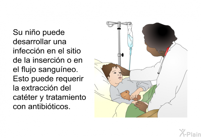 Su nio puede desarrollar una infeccin en el sitio de la insercin o en el flujo sanguneo. Esto puede requerir la extraccin del catter y tratamiento con antibiticos.