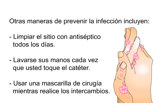 Otras maneras de prevenir la infeccin incluyen:  Limpiar el sitio con antisptico todos los das. Lavarse sus manos cada vez que usted toque el catter. Usar una mascarilla de ciruga mientras realice los intercambios.