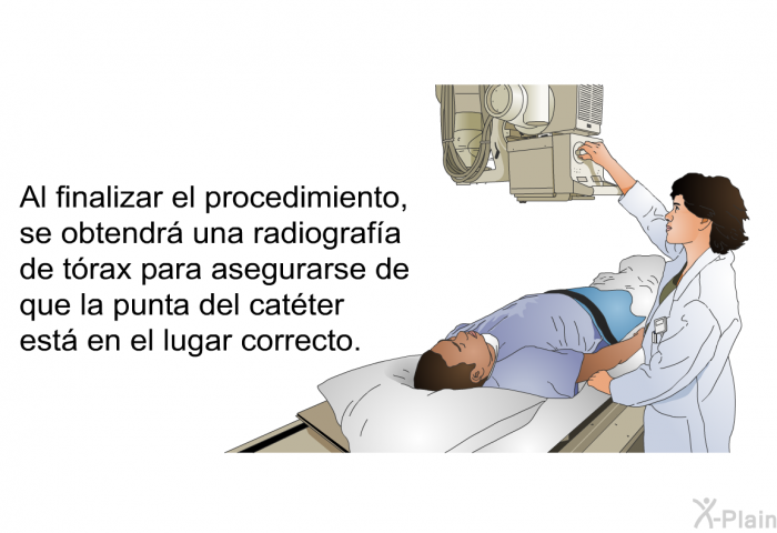 Al finalizar el procedimiento, se obtendr una radiografa de trax para asegurarse de que la punta del catter est en el lugar correcto.