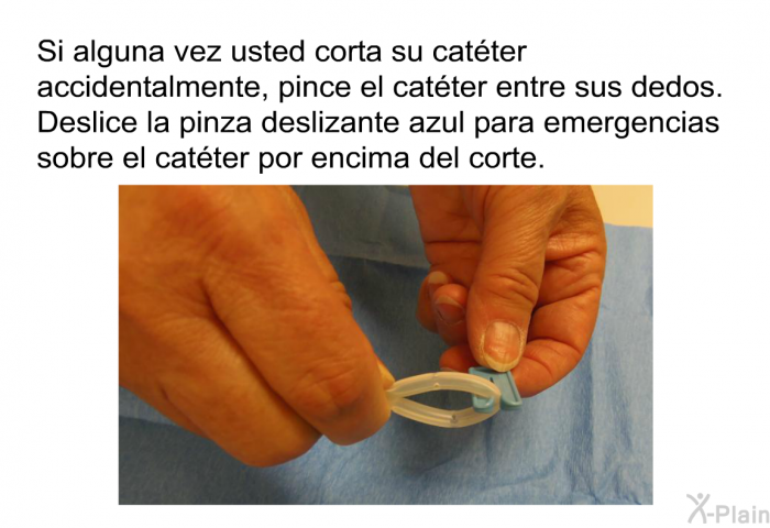 Si alguna vez usted corta su catter accidentalmente, pince el catter entre sus dedos. Deslice la pinza deslizante azul para emergencias sobre el catter por encima del corte.