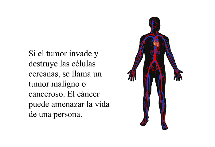 Si el tumor invade y destruye las clulas cercanas, se llama un tumor maligno o canceroso. El cncer puede amenazar la vida de una persona.