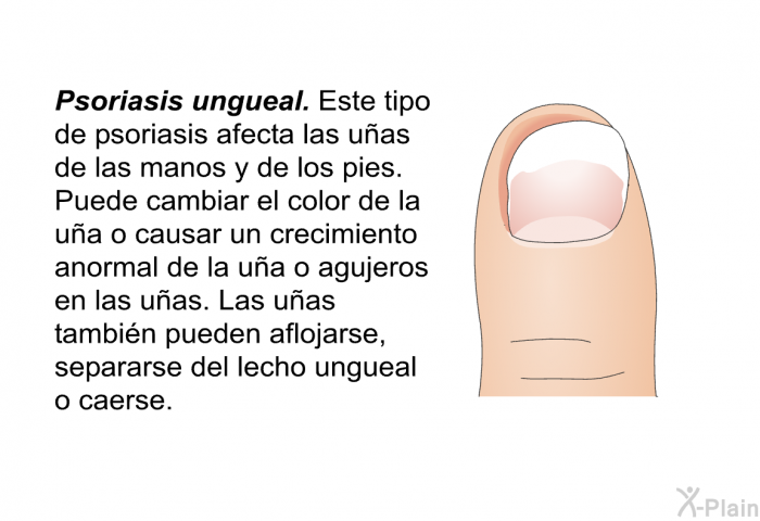 <I><B>Psoriasis ungueal</B></I>. Este tipo de psoriasis afecta las uas de las manos y de los pies. Puede cambiar el color de la ua o causar un crecimiento anormal de la ua o agujeros en las uas. Las uas tambin pueden aflojarse, separarse del lecho ungueal o caerse.