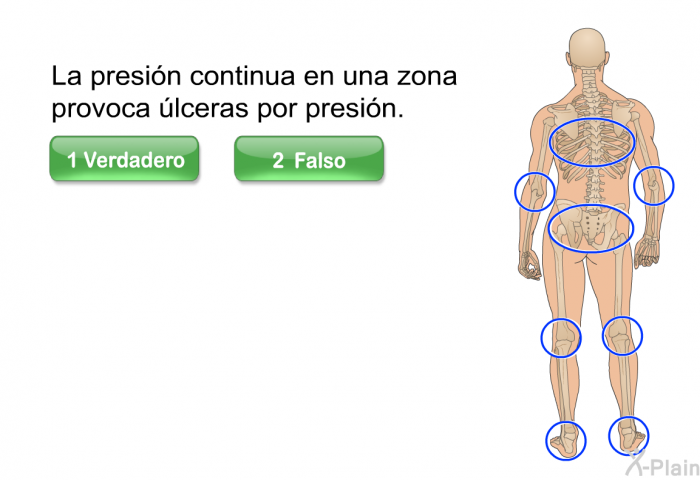 La presin continua en una zona provoca lceras por presin.