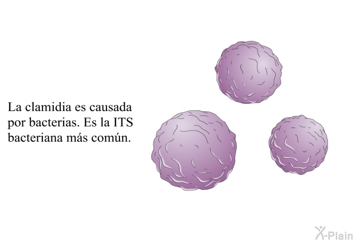 La clamidia es causada por bacterias. Es la ITS bacteriana ms comn.