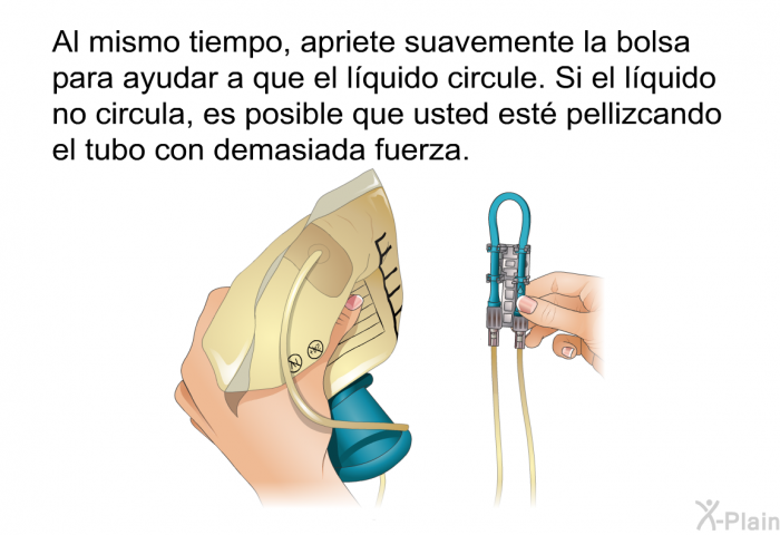 Al mismo tiempo, apriete suavemente la bolsa para ayudar a que el lquido circule. Si el lquido no circula, es posible que usted est pellizcando el tubo con demasiada fuerza.