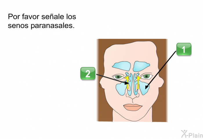 Por favor seale los senos paranasales.