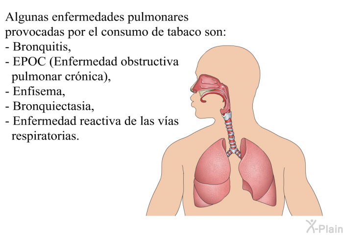 Tabaquismo - Enfermedades del aparato respiratorio - Enfermedades -  Medicina Interna Basada en la Evidencia