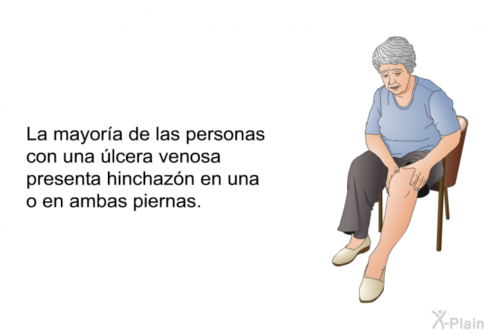 La mayora de las personas con una lcera venosa presenta hinchazn en una o en ambas piernas.