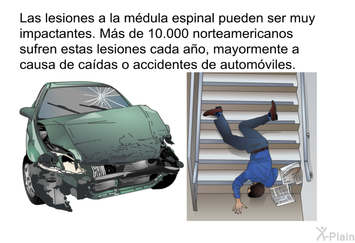 Las lesiones a la m�dula espinal pueden ser muy impactantes. M�s de 10.000 norteamericanos sufren estas lesiones cada a�o, mayormente a causa de ca�das o accidentes de autom�viles.