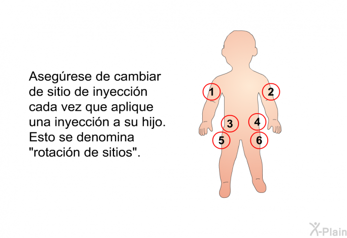 Asegrese de cambiar de sitio de inyeccin cada vez que aplique una inyeccin a su hijo. Esto se denomina “rotacin de sitios”.