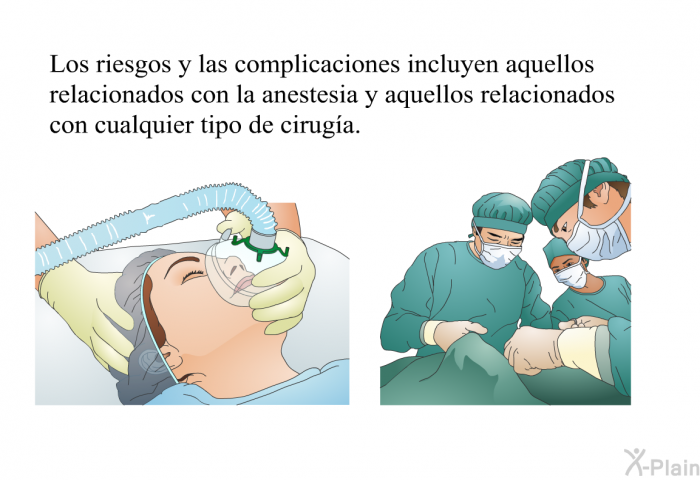 Los riesgos y las complicaciones incluyen aquellos relacionados con la anestesia y aquellos relacionados con cualquier tipo de ciruga.
