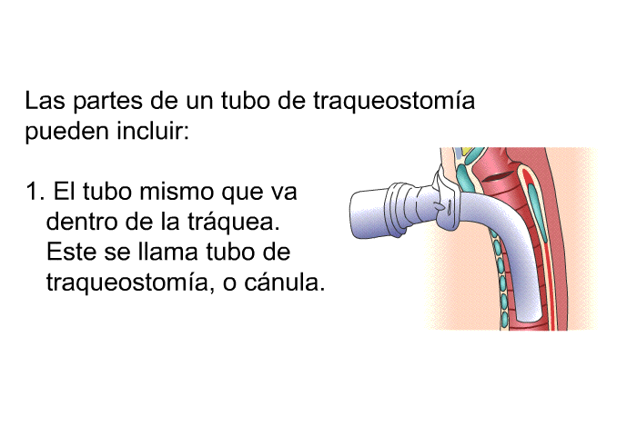 Las partes de un tubo de traqueostoma pueden incluir:  El tubo mismo que va dentro de la trquea. Este se llama tubo de traqueostoma, o cnula.