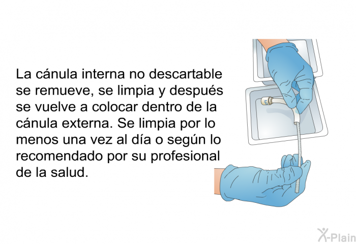 La cnula interna no descartable se remueve, se limpia y despus se vuelve a colocar dentro de la cnula externa. Se limpia por lo menos una vez al da o segn lo recomendado por su profesional de la salud.