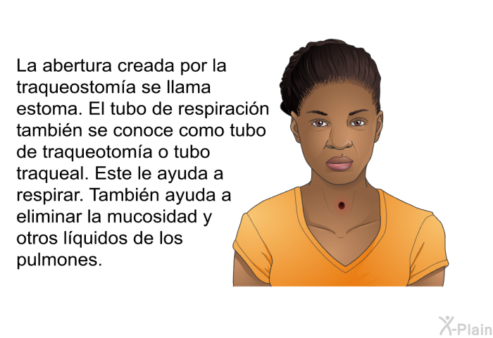 La abertura creada por la traqueostoma se llama estoma. El tubo de respiracin tambin se conoce como tubo de traqueotoma o tubo traqueal. Este le ayuda a respirar. Tambin ayuda a eliminar la mucosidad y otros lquidos de los pulmones.