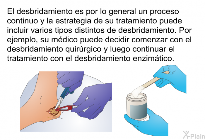 El desbridamiento es por lo general un proceso continuo y la estrategia de su tratamiento puede incluir varios tipos distintos de desbridamiento. Por ejemplo, su mdico puede decidir comenzar con el desbridamiento quirrgico y luego continuar el tratamiento con el desbridamiento enzimtico.