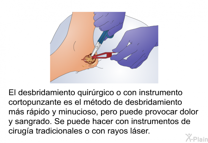 El desbridamiento quirrgico o con instrumento cortopunzante es el mtodo de desbridamiento ms rpido y minucioso, pero puede provocar dolor y sangrado. Se puede hacer con instrumentos de ciruga tradicionales o con rayos lser.