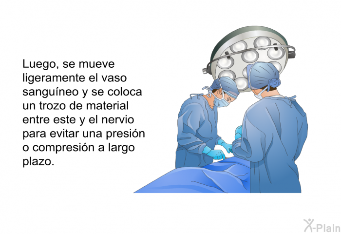 Luego, se mueve ligeramente el vaso sangu�neo y se coloca un trozo de material entre este y el nervio para evitar una presi�n o compresi�n a largo plazo.