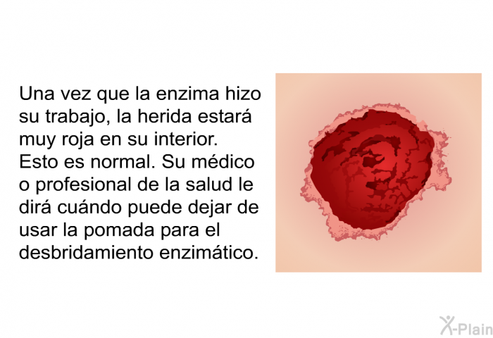 Una vez que la enzima hizo su trabajo, la herida estar� muy roja en su interior. Esto es normal. Su m�dico o profesional de la salud le dir� cu�ndo puede dejar de usar la pomada para el desbridamiento enzim�tico.
