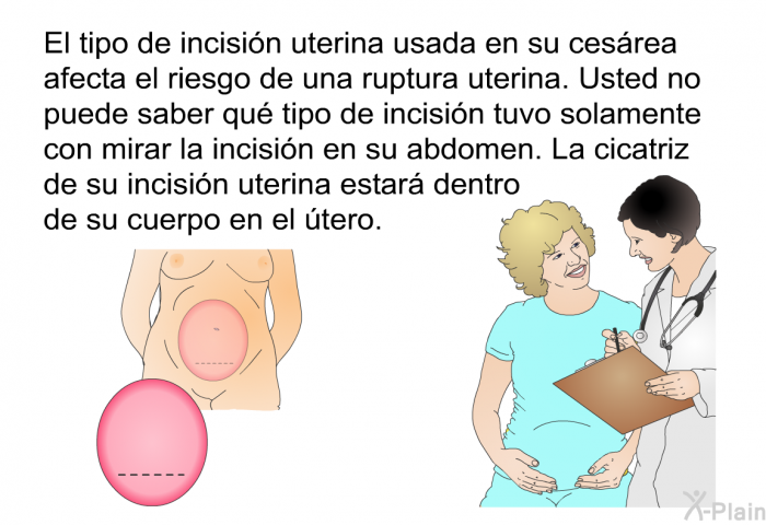 El tipo de incisin uterina usada en su cesrea afecta el riesgo de una ruptura uterina. Usted no puede saber qu tipo de incisin tuvo solamente con mirar la incisin en su abdomen. La cicatriz de su incisin uterina estar dentro de su cuerpo en el tero.