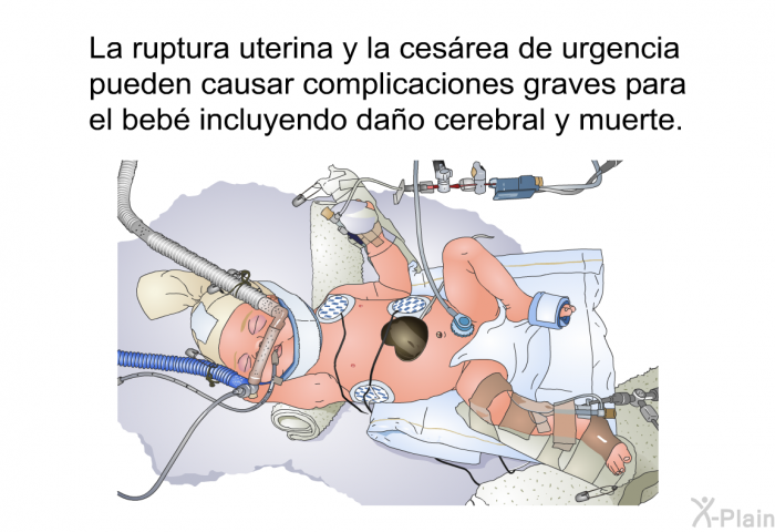 La ruptura uterina y la cesrea de urgencia pueden causar complicaciones graves para el beb incluyendo dao cerebral y muerte.