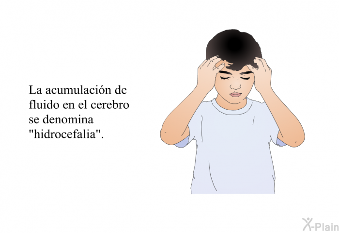 La acumulacin de fluido en el cerebro se denomina “hidrocefalia”.