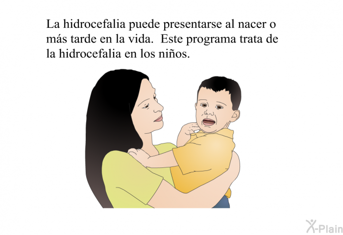 La hidrocefalia puede presentarse al nacer o ms tarde en la vida. Esta informacin acerca de su salud trata de la hidrocefalia en los nios.