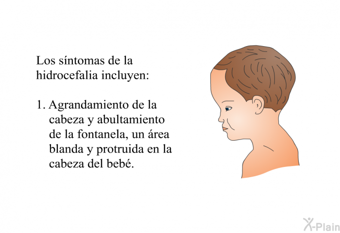 Los sntomas de la hidrocefalia incluyen:  Agrandamiento de la cabeza y abultamiento de la fontanela, un rea blanda y protruida en la cabeza del beb.